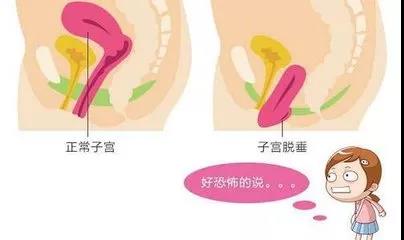 ڲ޸