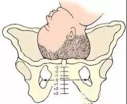 ޸